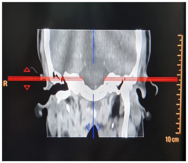 Figure 2.