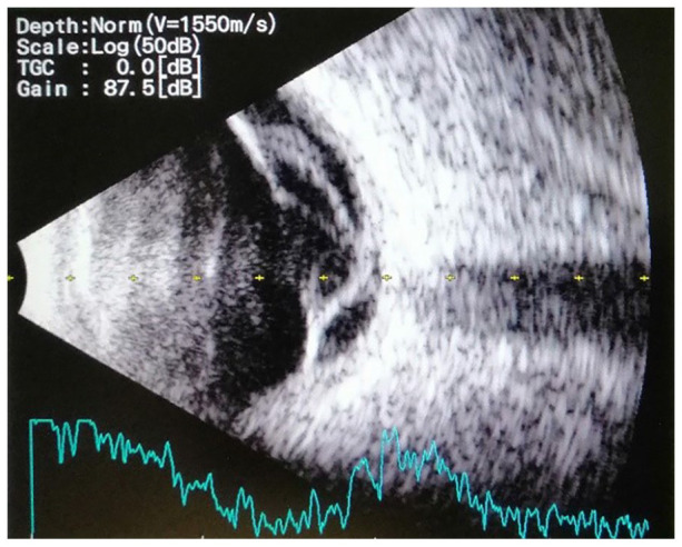 Figure 4.