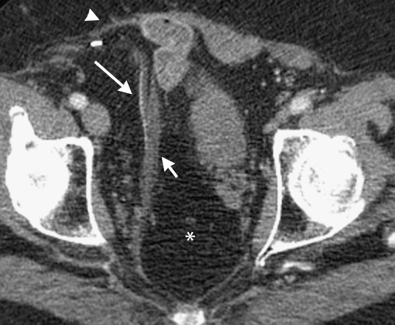 Fig. 2