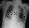 Fig. 1