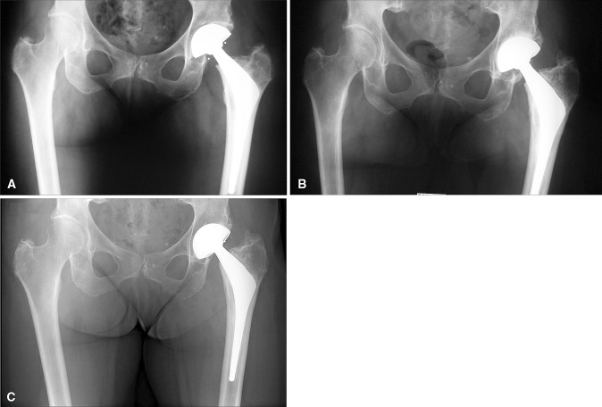 Fig. 5A–C