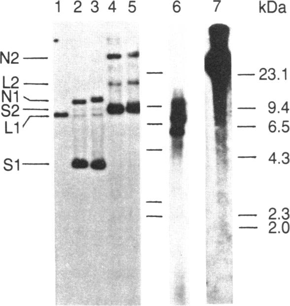 graphic file with name pnas00317-0108-a.jpg