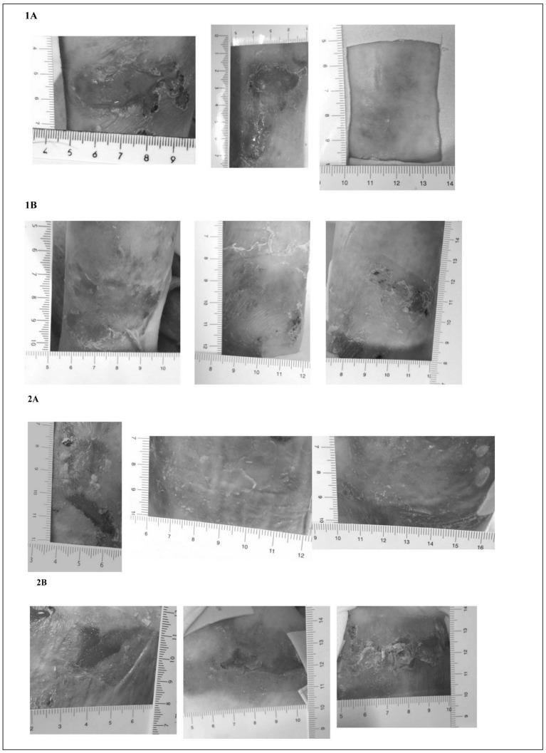 Figure 1a