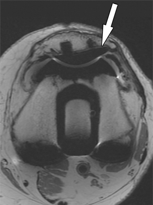 Figure 4b