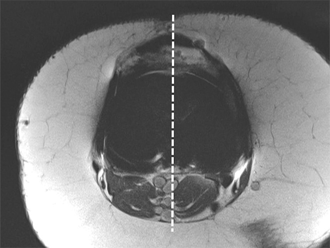 Figure 17a