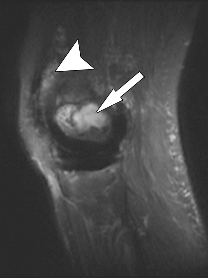 Figure 9b