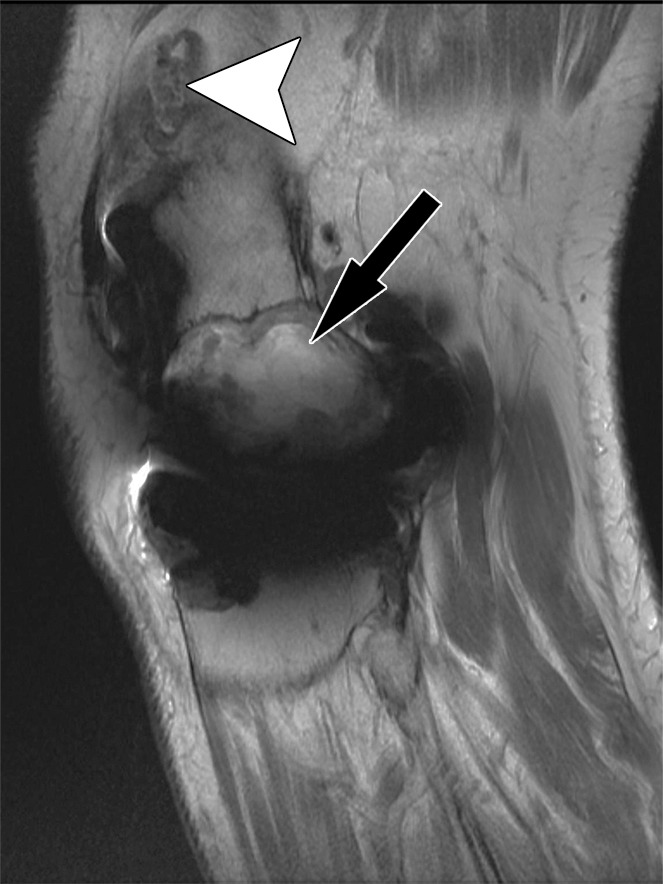 Figure 9a