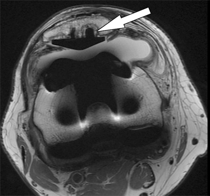 Figure 5a