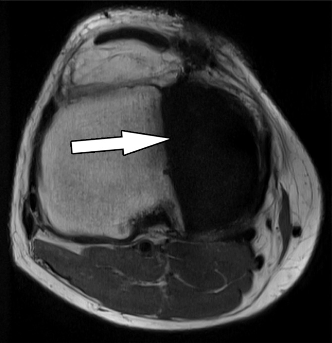 Figure 1b