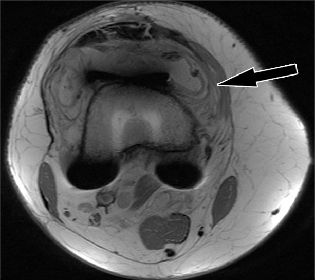 Figure 15a