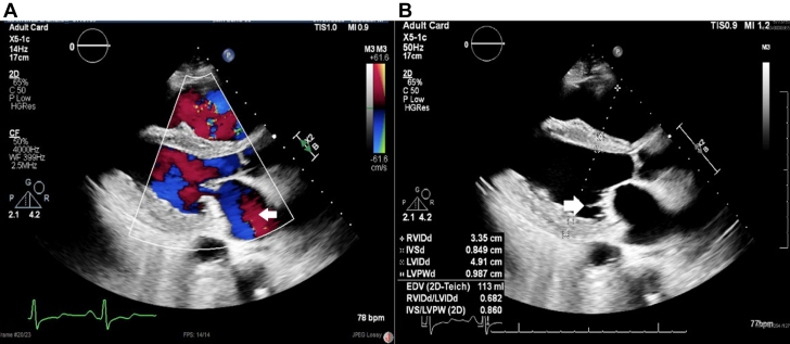 Figure 1