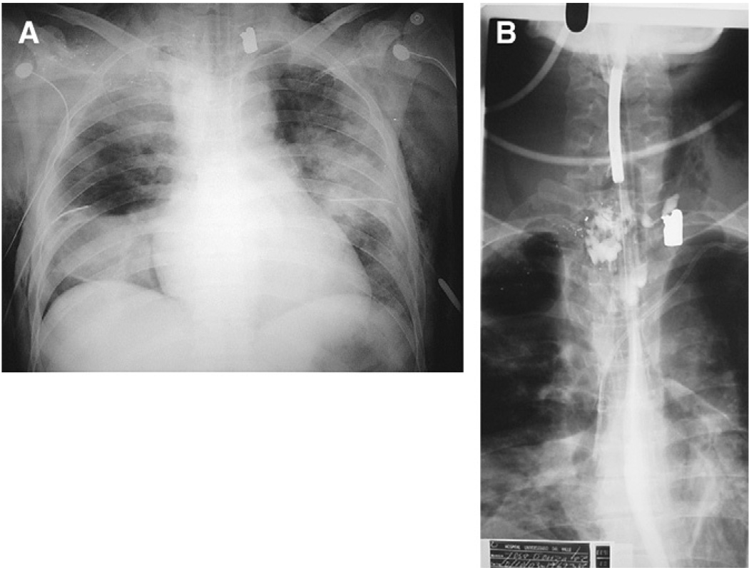 Fig. 10