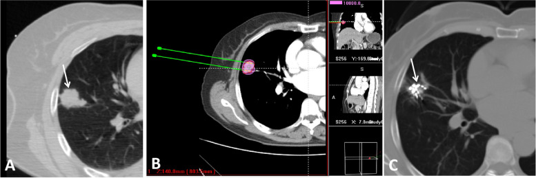 Fig. 2