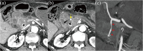 FIGURE 2