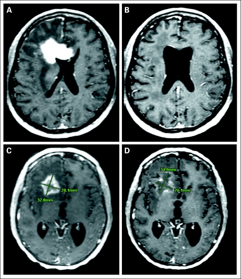 Fig 2.