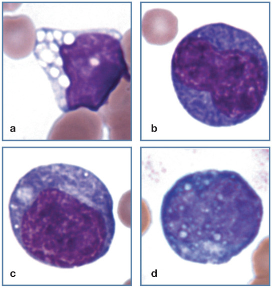 Figure 14