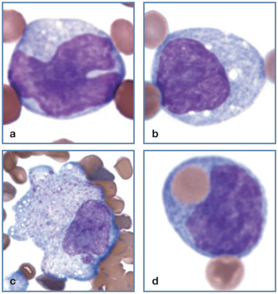 Figure 17