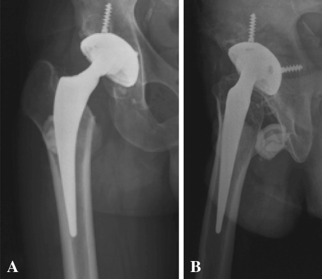 Fig. 1A–B