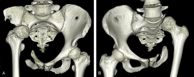 Fig. 7 A-B