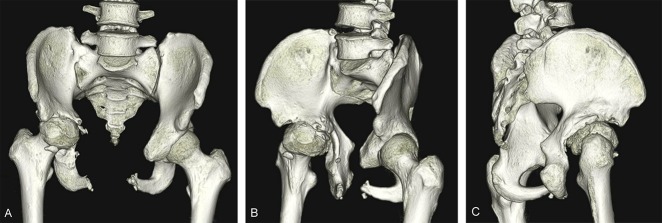 Fig. 8 A-C