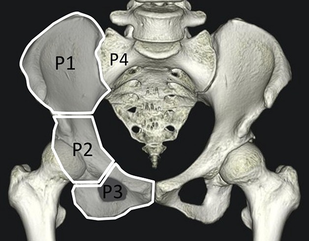 Fig. 1