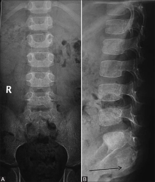 Figure 15(A and B)