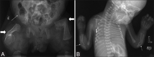 Figure 5(A and B)