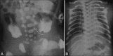 Figure 4(A and B)