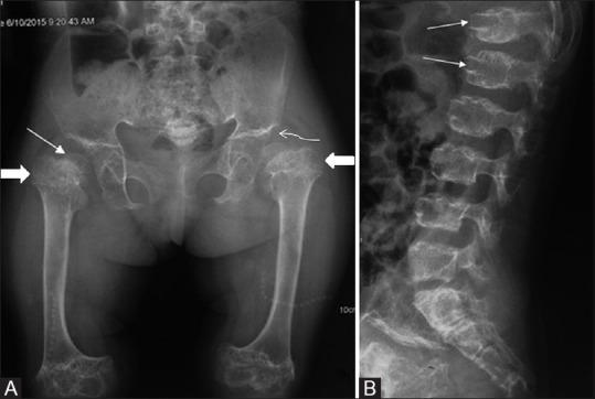 Figure 21(A and B)