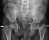 Figure 25
