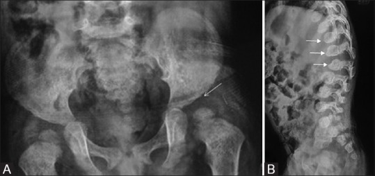 Figure 3(A and B)