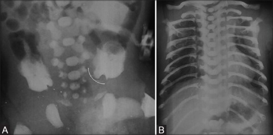 Figure 4(A and B)