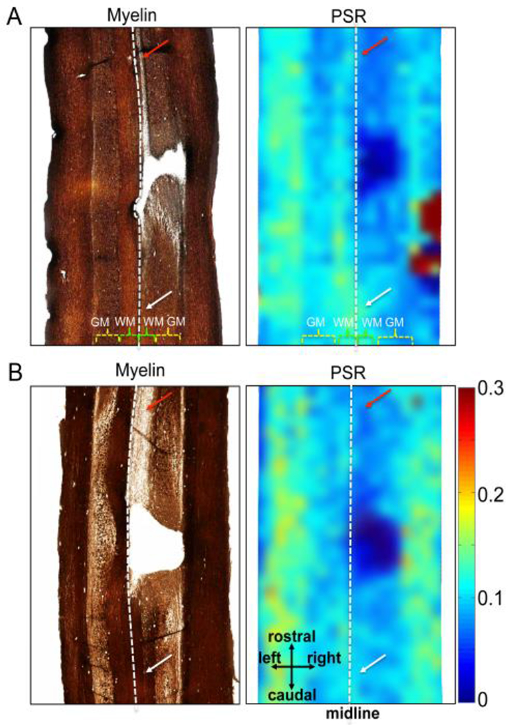 Figure 11.