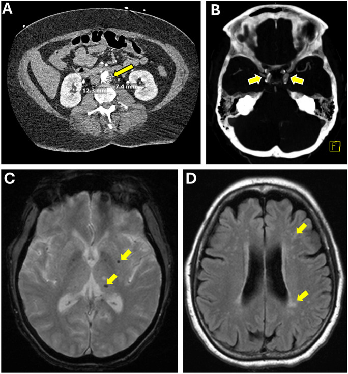 Fig. 4