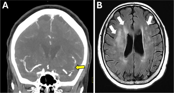 Fig. 2