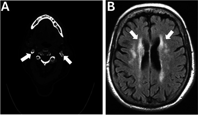 Fig. 3