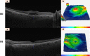 Fig. 4