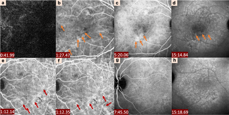 Fig. 3