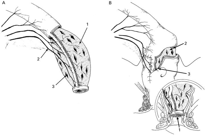 Figure 1  