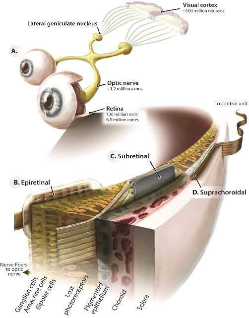 Figure 1.2.