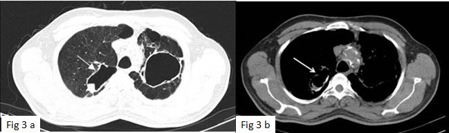 [Table/Fig-3a, b]: