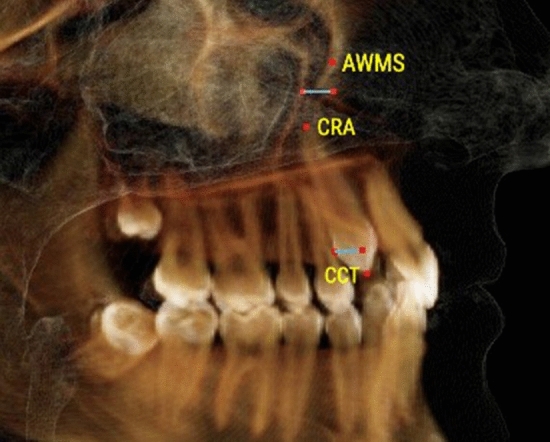 Fig. 2