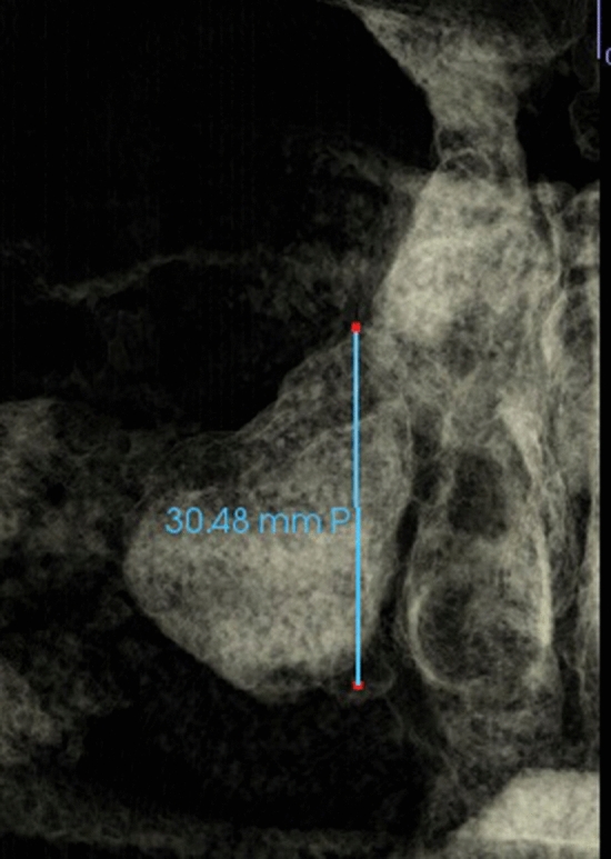 Fig. 7