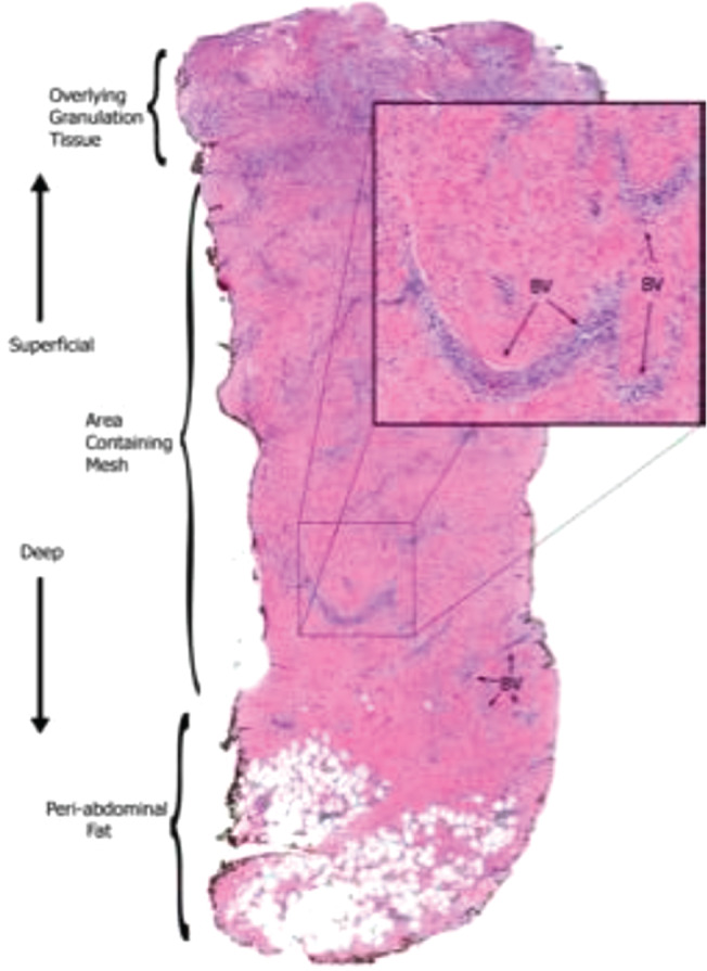 IWJ-12558-FIG-0007-c