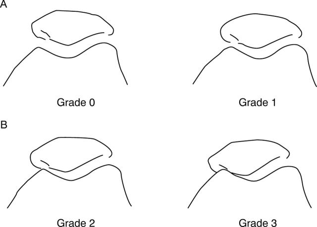 Figure 11  