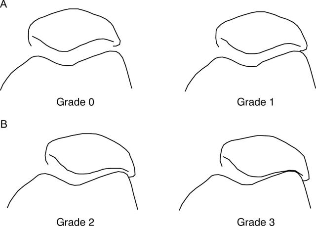 Figure 3  