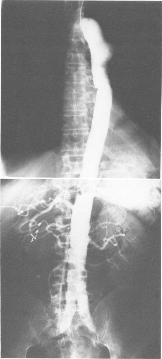 Fig. 5n.