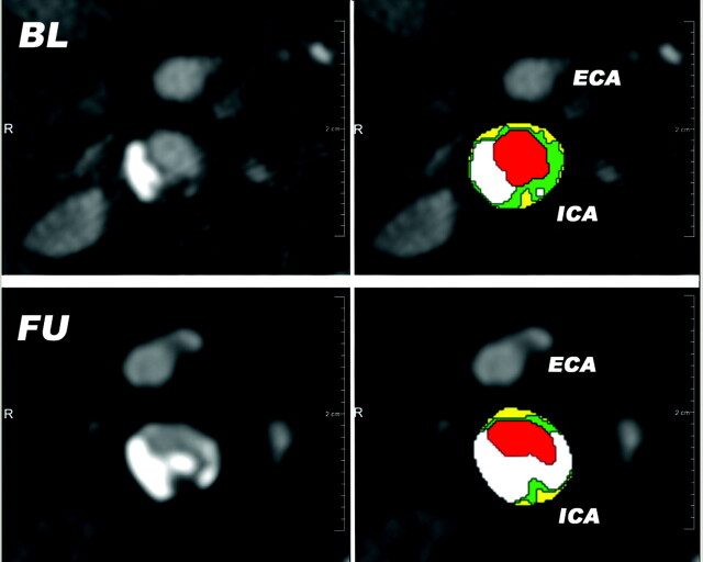 Fig 2.