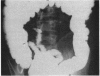 213