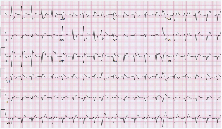 Figure 2